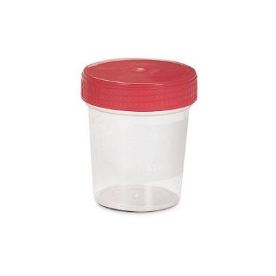 CONTENITORE STERILE PER LA RACCOLTA URINA 120 ML